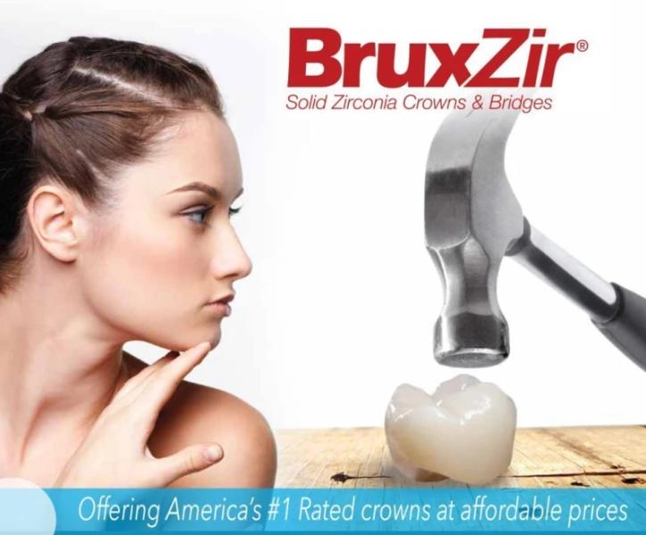 Affordable Dental Crowns in San Diego – Mesa Dental